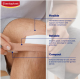 Elastoplast 45773 Tapes Elastic Fabric Roll Plaster 2.5cmx3m